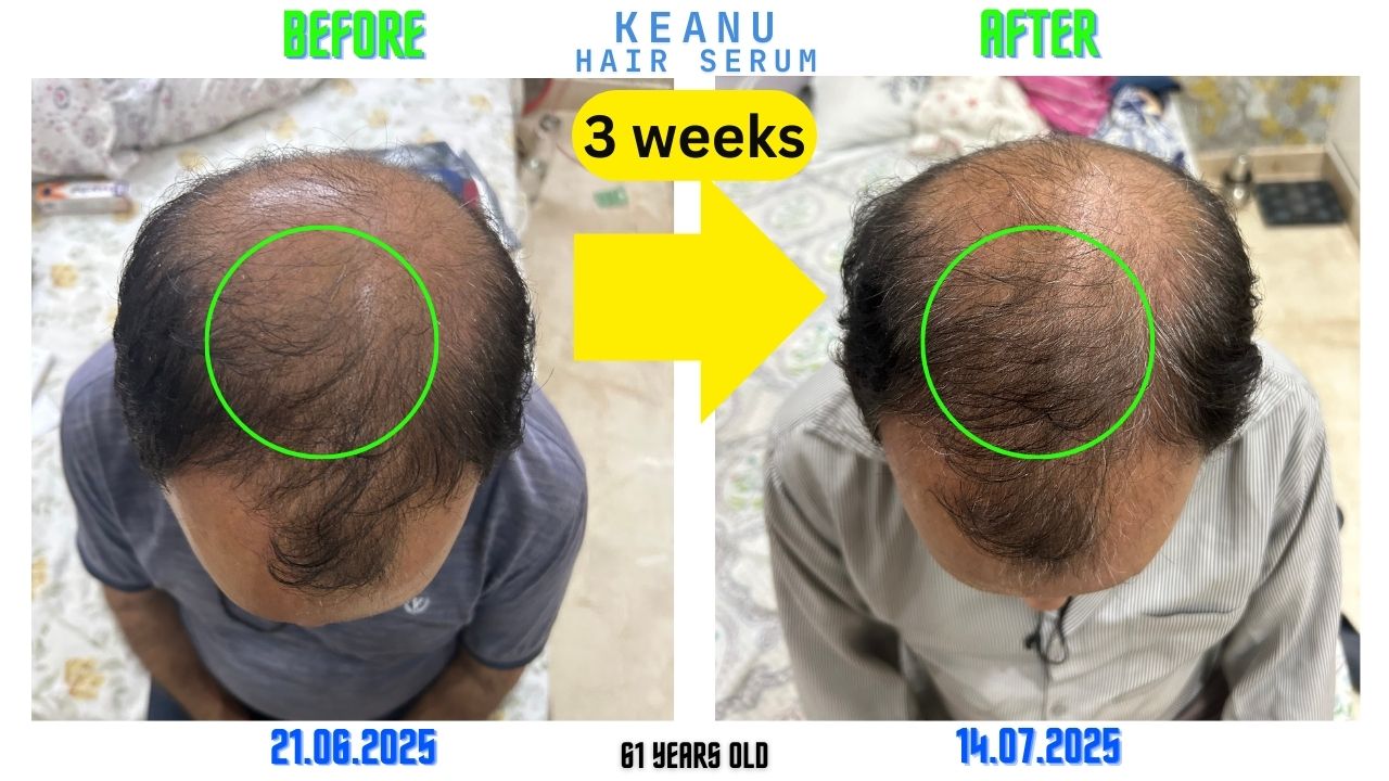 Before and after top-view photographs from KEANU materials, dated 21 June and 14 July 2025
